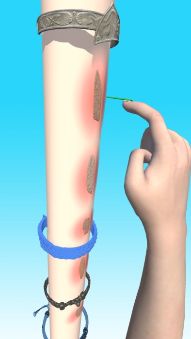 疤痕快跑游戏的图册