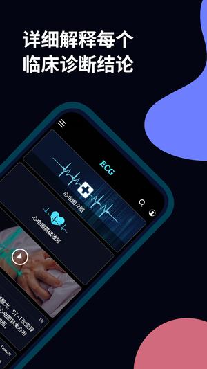 心电图ECG的图册