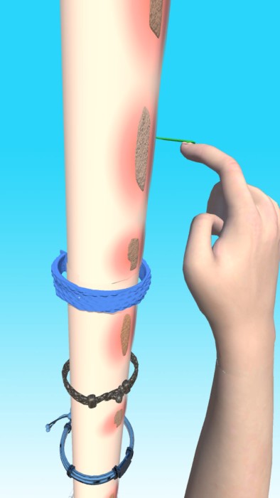 疤痕快跑游戏的图册