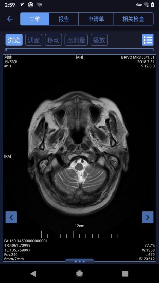 东软睿影官方版的图册