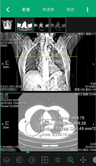 易影云影像平台的图册