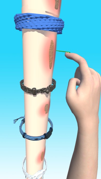 疤痕快跑游戏的图册